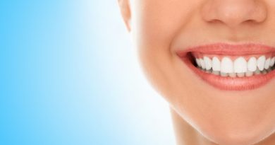 Dents bien alignées