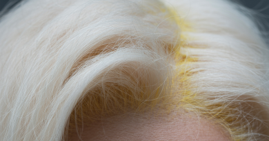 découvrez l'effet de la bétadine sur les cheveux blancs : influence, risques de coloration ou de jaunissement, conseils pour préserver l'éclat naturel de vos cheveux gris ou blancs.